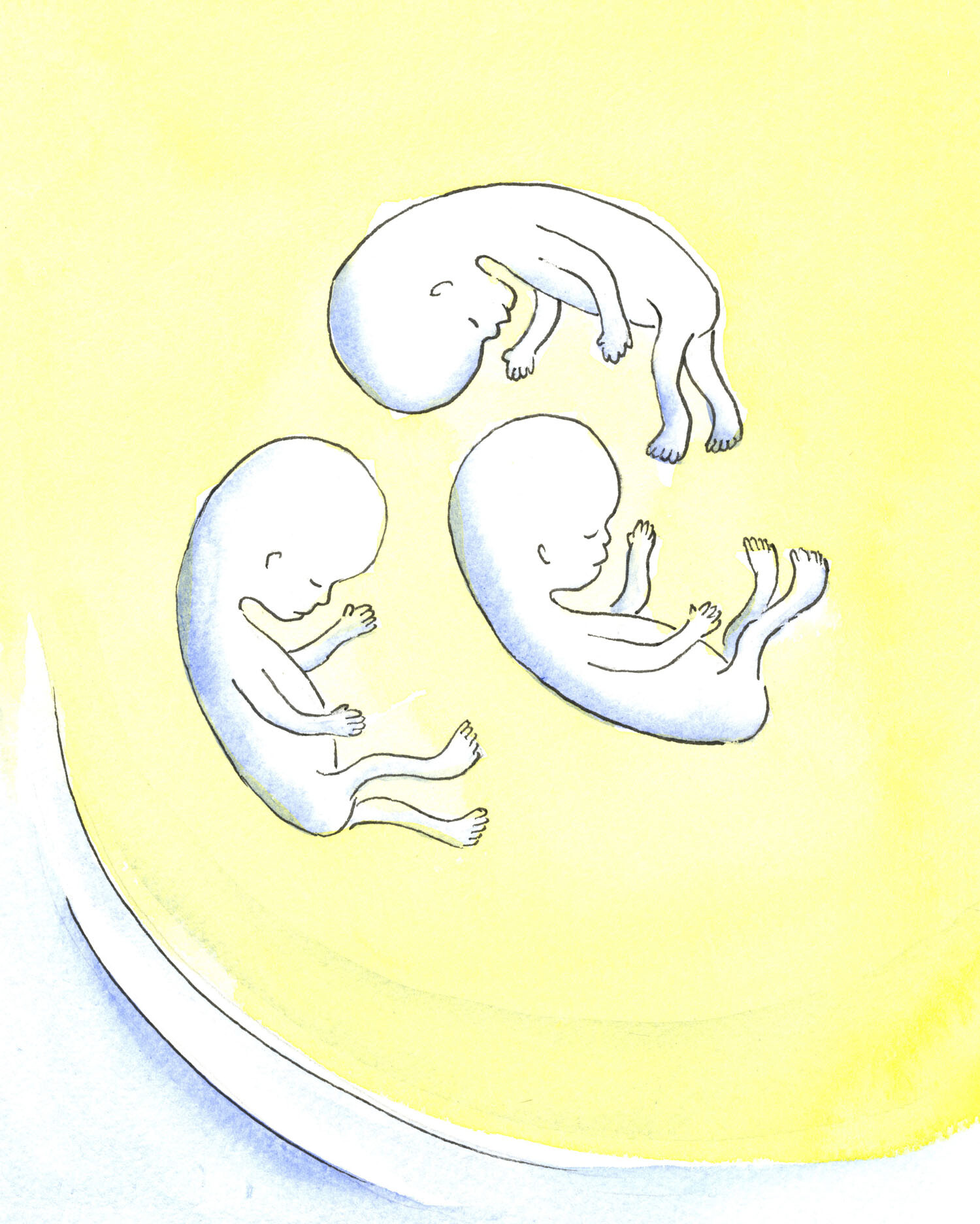 Life is precious. God gives life to every human being; and we should respect every human being, at every stage of that person's existence - from conception until natural death.