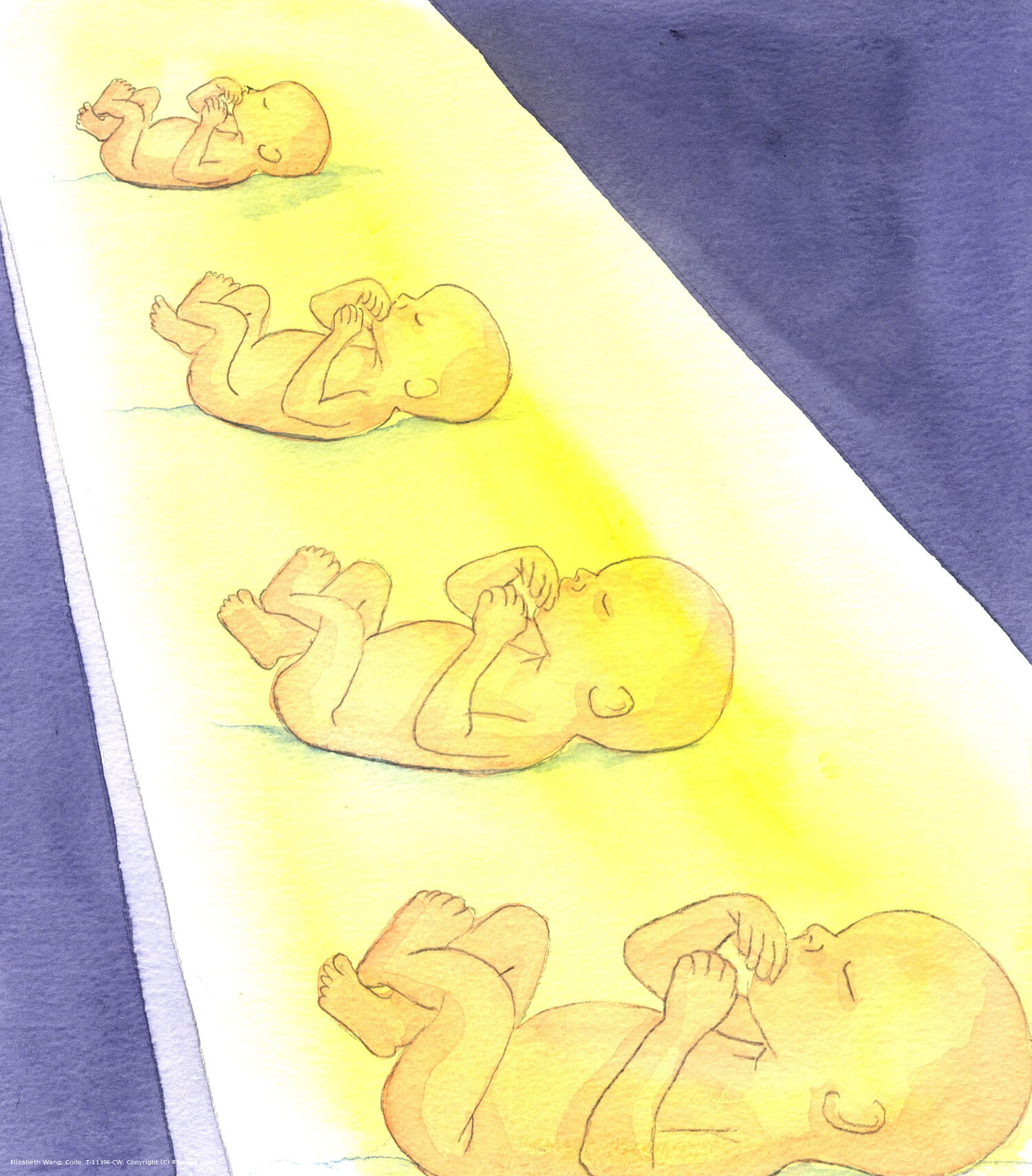 There are people who deny that abortion involves the taking of human life; yet in every abortion clinic there are little dead bodies to be disposed of daily: treated as so much hospital waste, with no respect; and where bodies are, there has plainly been either illness or accident or a deliberate killing; and abortion is the deliberate killing of an innocent human being.